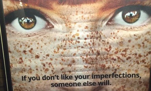 match-freckles-ad
